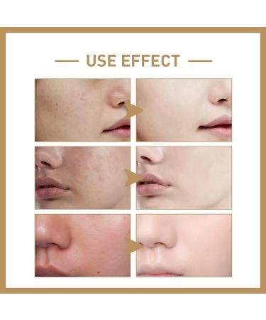 150ml Rice Toner Rice Water Rice Face Toner Hydrating Toner for Face Natural Moisturizer Glow Essence Hydrating and Moisturizing Rice Extract Smoothing Toner for Face Essential Toner Deep Hydration - Buy Online on GoSupps.com