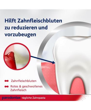 Parodontax Complete Protection Toothpaste with Fluoride - 5 Pack (75ml) | Reduces Bleeding Gums | International Shipping Available - Buy Online on GoSupps.com