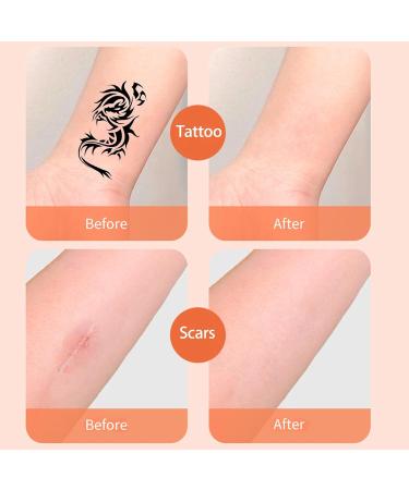 Patch de couverture de tatouage 10 pi ces patch de couverture imperm able ultra mince l'apparence naturelle pour les tatouages les cicatrices et les marques de naissance. (Medium Skin Color) - Buy Online on GoSupps.com