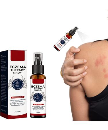 GFOUK Natural Eczema Therapy Spray All Natural Eczema Treatment Psoriasis Treatment Vitiligo Skin Repair Spray Skin Care Pain & Itch Spray Fast Acting Itch Relief (1 Pcs)