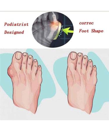Women's Orthopedic Bunion Corrector Sandals - Big Toe Correction Splints - Casual & Comfortable Summer Shoes - Black - Size 43CN - Buy Online on GoSupps.com