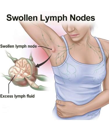 GreenHB Herbal Lymph Care Patch 10 Pcs - Neck Lymphatic Drainage Patch with Ginger Oil for Swelling & Pain Relief - Buy Online on GoSupps.com