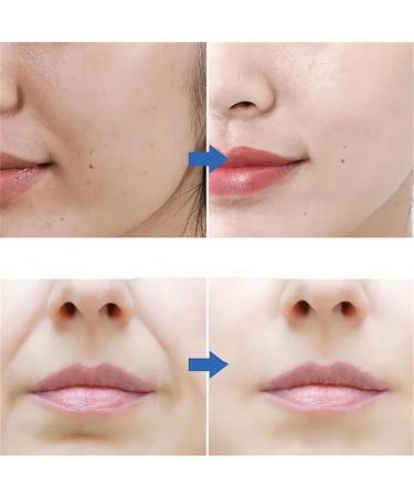 JIAOY Joyland Wrinkle plasters Joyland wrinkle remover firming and firming masks for forehead eyes and nose and lip wrinkles firming wrinkle remover deepacting 10 pieces Forehead 10 pieces - Buy Online on GoSupps.com