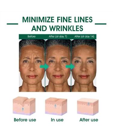 Buy Skin Firming Rejuvenating Serum for All Skin Types - Firming Serum for Face & Neck (1Pcs) - International Shipping Available - Buy Online on GoSupps.com