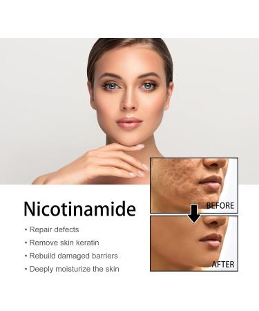 JUNYOUDA Nicotinamide Serum for Blemishes Niacinamide Freckles Removal Serum Whitening freckle removing and moisturizing essence for All Type Skin - Buy Online on GoSupps.com