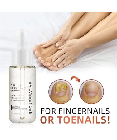 GFOUK 7 Days Nail Growth And Strengthening Serum Nail Growth and Strength Serum Nail Growth & Strengthening Oil Serum Stronger Nails in 1 Week Nail Strengthening Treatment (1 Pcs) - Buy Online on GoSupps.com
