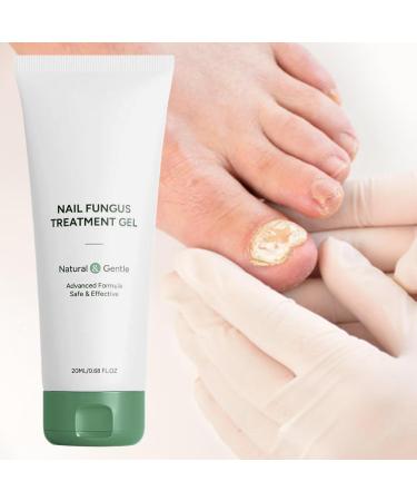 Gel for damaged nails | Repairing cream 20 ml for damaged and yellowed toenails moisturizing treatment for thick hard sensitive dry and cracked nails for daily use at home - Buy Online on GoSupps.com