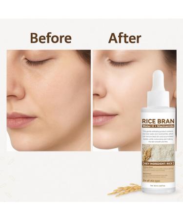 3PCS Essence Toner White Rice Ampoule Skin Softening Essence Exfoliate Face Scrub Dead Skin Fade Essence Brighten Body - Buy Online on GoSupps.com