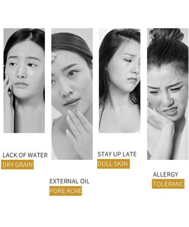 siduytin Women Face Wrinkle Removal Ladies Natural Ingredient Moisturizing Hydrating Firming for Essence Anti-age Stock Solution - Buy Online on GoSupps.com