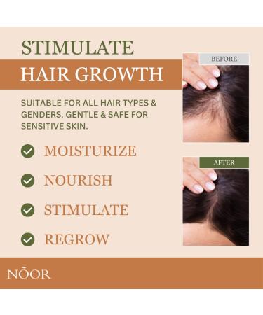NOOR HAIR Rosemary Growth Spray for Women | Natural Hair Loss Treatment | Thicker Healthier Hair in 8-12 Weeks | Easy Application - Buy Online on GoSupps.com