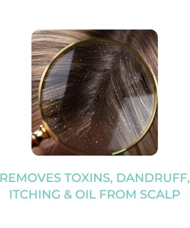 Herbal Loss Prevention Shampoo | Herbal Shampoo | Natural Ingredients | Hair Regrowth & Damage Control | Hair Loss Treatment | 200ml - Buy Online on GoSupps.com