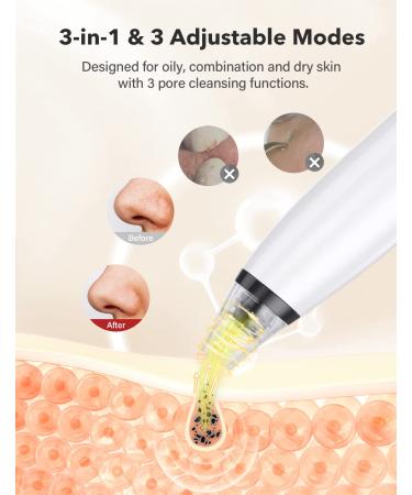 BEBIRDPRO Ear Wax Removal Tool with HD Camera and 6 LED Lights - Safely Clean Ear Canal at Home | Ear Cleaner for iOS Android Smart Phones - M9 Red - Buy Online on GoSupps.com