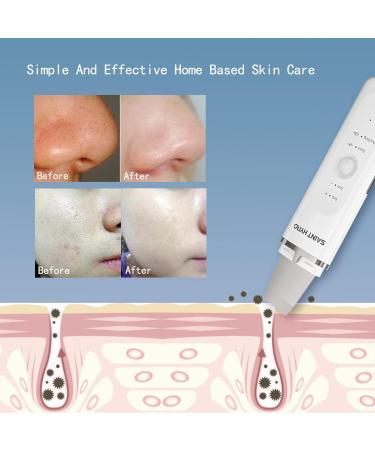 Saint Hyro Pore Skin Scrubber Blackhead Remover | 4 Modes Exfoliator & Cleanser with Ion Function | USB Charger | Face Scraper Machine - Buy Online on GoSupps.com
