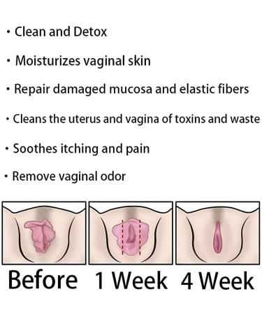 Alkyne Anniecare Instant Anti-Itch Detox Slimming & Vaginal Tightening Capsules (2 Bags) - Natural Repair Formula - Buy Online on GoSupps.com