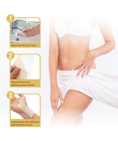 HANASCAR Professional Silicone Scar Removal Sheets - Treat C-Section, Burn, Acne & Stretch Mark Scars - Works on Old & New Scars - 5.7 x 1.57 - Buy Online on GoSupps.com
