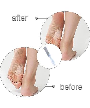 Pedicure File Double Sided Stainless Steel Feet Exfoliator Easy Grip Handle Foot Rasp File for Women Men Foot Care Dead Skin Dry Cracked - Buy Online on GoSupps.com