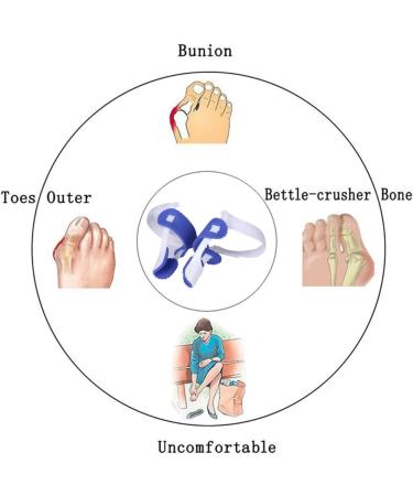 Yipoch Big Toe Bunion Straightener - Hallux Valgus Corrector & Bunion Splint for Unisex Foot Care | Shop Now for Pain Relief - Buy Online on GoSupps.com