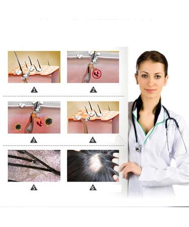 Hair Growth Serum - Stimulate New Growth Thicker Hair & Prevent Hair Loss | Fast-Acting Treatment for Fuller Hair - Buy Online on GoSupps.com