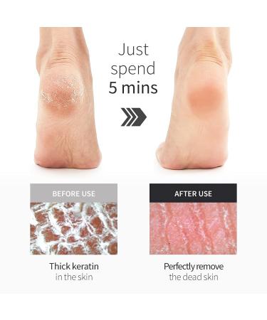 TOOLA Hypoallergenic Glass Foot Rasp File and Callus Remover (2 Pack) - Gentle Pedicure Tools for Dry/Wet Feet - Irritation-Free Foot Scrubber - Buy Online on GoSupps.com