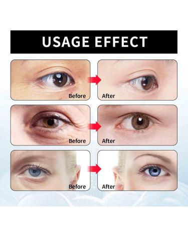 Eye Serum & Firming Cream - Combat Dark Circles Wrinkles & Puffiness (4PCs) - Buy Online on GoSupps.com