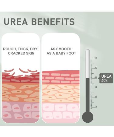 Urea Cream 40% - Pro Foot & Hand Cream for Dry Cracked Skin Moisturizing Urea Lotion for Heels Knees & Elbows - 5.29 oz - Buy Online on GoSupps.com