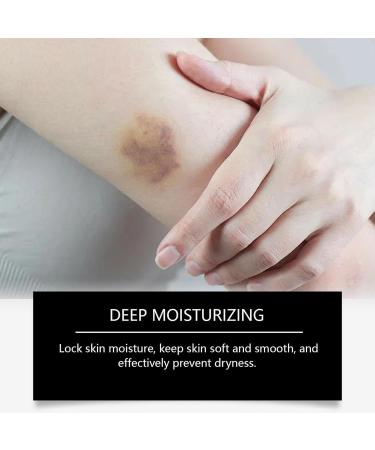 Duqulle Facial scar cream 50 g scars soothing care care for face body caesarean section wounds burns old and new scars - Buy Online on GoSupps.com