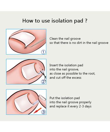60+2 Pack Ingrown Toenail Treatment Set - Includes Corrector Strips, Lifter, and Nail Clipper - Professional Ingrown Toenail Correction Tool - Buy Online on GoSupps.com