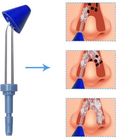IIYL Nose Washing Replacement Tips for Waterpik Oral Irrigator Wp-100 Wp-450 Wp-250 Wp-300 Wp-660 Wp-900 by (6-Pack) - Buy Online on GoSupps.com