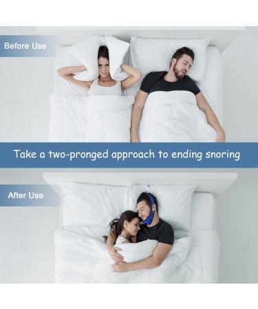 Anti-Snoring Chin Strap & Snoring Stopper Set - Effective Solutions to Reduce Snoring Noises - Buy Online on GoSupps.com