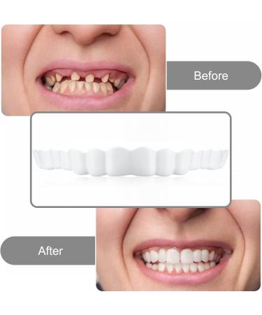 Buy 2 Pairs of Temporary Dentures | Perfect Smile Veneers Snap-On Teeth | Clip-On Top & Bottom Fake Teeth | Instant Natural Dentures - Buy Online on GoSupps.com