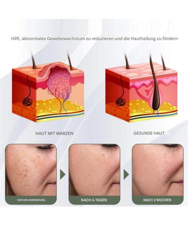 Duqulle Point Covering Face Cream Moisturizing Facial Care Naturally Moisturizing 50g Unisex Facial Water for Skin for Daily Use Smooth - Buy Online on GoSupps.com