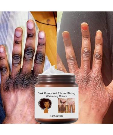 120g Crema Para Aclarar Las Axilas Y Partes Intimas Crema Aclaradora Para Piel Manchas En Cara Axilas Cuello Entrepierna Crema Blanqueadora Para Partes Intimas - Buy Online on GoSupps.com