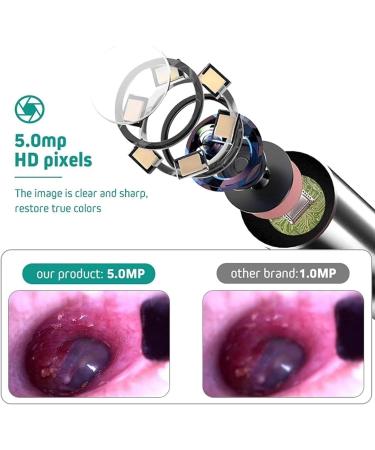 EYEARN Visual Ear Wax Removal Tool with 5-inch Screen | Portable Ear Cleaner Kit with Inspection Camera for Easy Cleaning - Buy Online on GoSupps.com