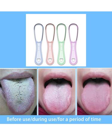 Auklopvzz Tongue Cleaner for Adults - Double-Sided Reusable Hygiene Brush for Fresh Breath - Unisex Plastic Scraper Tool in Light Green - Buy Online on GoSupps.com