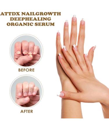 NailGrowth DeepHealing Organic Serum NailGrowth Serum Reconstrux Nail Growth Nail Growth and Strength Serum Nail Growth Serum Nail Repair Essence Serum 30ml (3Pcs) - Buy Online on GoSupps.com