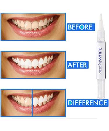 LPDM Dazzling White No Sensitivity Advance Natural Instant Whitening Pen Teeth Whitening Pen 3 Pens 4 Shades Whiter in A Week for Teeth Whitening and Brightening Tooth Whitening Pen (3 Pack) - Buy Online on GoSupps.com