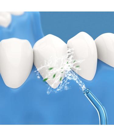 Water Flosser Tips Replacement for Coslus Oral Irrigator - 4 PCS Jet Nozzle Heads | Best Oral Care Accessory - Buy Online on GoSupps.com