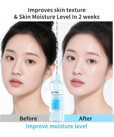 Bosongy Hydro Moisture Essence Toner 500ml(16.9fl.oz.) Deep Nourishing Facial Toner for Dry & Sensitive Skin, Infused with Hyaluronic Acid, Panthenol &Azelaic Acid Toner Korean Skincare - Buy Online on GoSupps.com