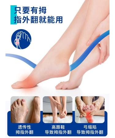 Orthopedic Toe Corrector for Men and Women - Thumb Valgus Relief - Buy Online on GoSupps.com