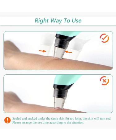 Blackhead Remover Pore Vacuum Cleaner - Electric Acne & Comedone Extractor | Facial Suction Tool for Men & Women - Blue - Buy Online on GoSupps.com