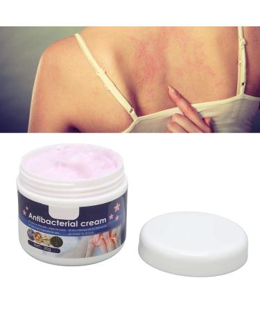 Gentle 30g Itch Relief Cream with Violets Cnidium Extract - Anti-Itch Ointment for Sensitive Dry Skin - Buy Online on GoSupps.com
