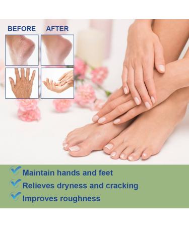 ACWOO Urea Foot Cream 60 Percent Plus 2 Salicylic Acid 2 pieces Urea Cream for Feet Nourishing Foot Cream for Cracked Heels and Dry Skin Deeply Moisturizing Repairing Cream for Cracked Heels - Buy Online on GoSupps.com