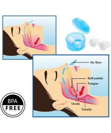 CLLOOM Anti Snore Device - Blue+Blue | Stop Snoring Now! - Buy Online on GoSupps.com
