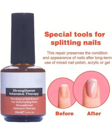 Nail Strengthener for Damaged Nails Crack Nail Repair Nail Polish Strengthener Nail Repair Essence Serum Strengthening Hardening Conditioner Extreme Strength Nail Serum Nail Repair&polish Treatment - Buy Online on GoSupps.com