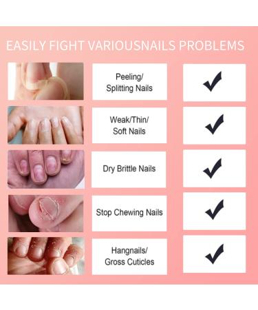 FLOWER Essence Cuticle Oil - Natural Moisturizing Formula with Vitamin E | 0.92 oz - Nourish & Revitalize Dry Nails - Buy Online on GoSupps.com