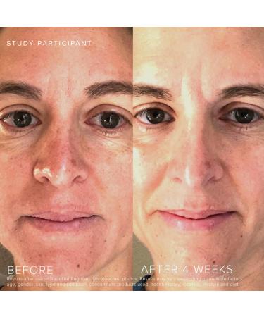 Buy Rodan + Fields Redefine Overnight Restorative Cream PM | Glow & Youthful Skin | International Shipping Available - Buy Online on GoSupps.com