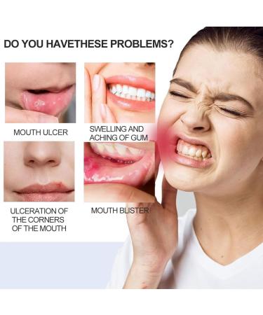 Mouth Spray for Soothing Relief | Mouth Ulcer & Sores Care | International Shipping - Buy Online on GoSupps.com