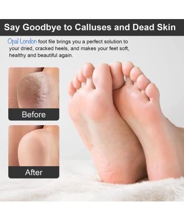 Opal London Blue Foot File with Handle - Buy Online on GoSupps.com