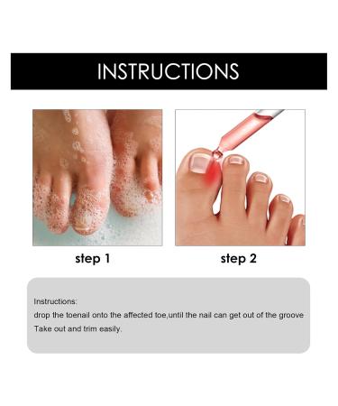 Ingrown Toenail Serum | Nail Care Oil for Brittle & Discolored Nails - 10ml - Hard Nail & Skin Treatment - Buy Online on GoSupps.com