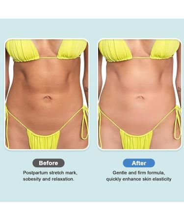 Elitzia Cruelty Free Vegan Formula Peach Feminine Body Firming Leaf Tummy Care Moisturizing Smoothing Belly Mask Vitamin E - Buy Online on GoSupps.com